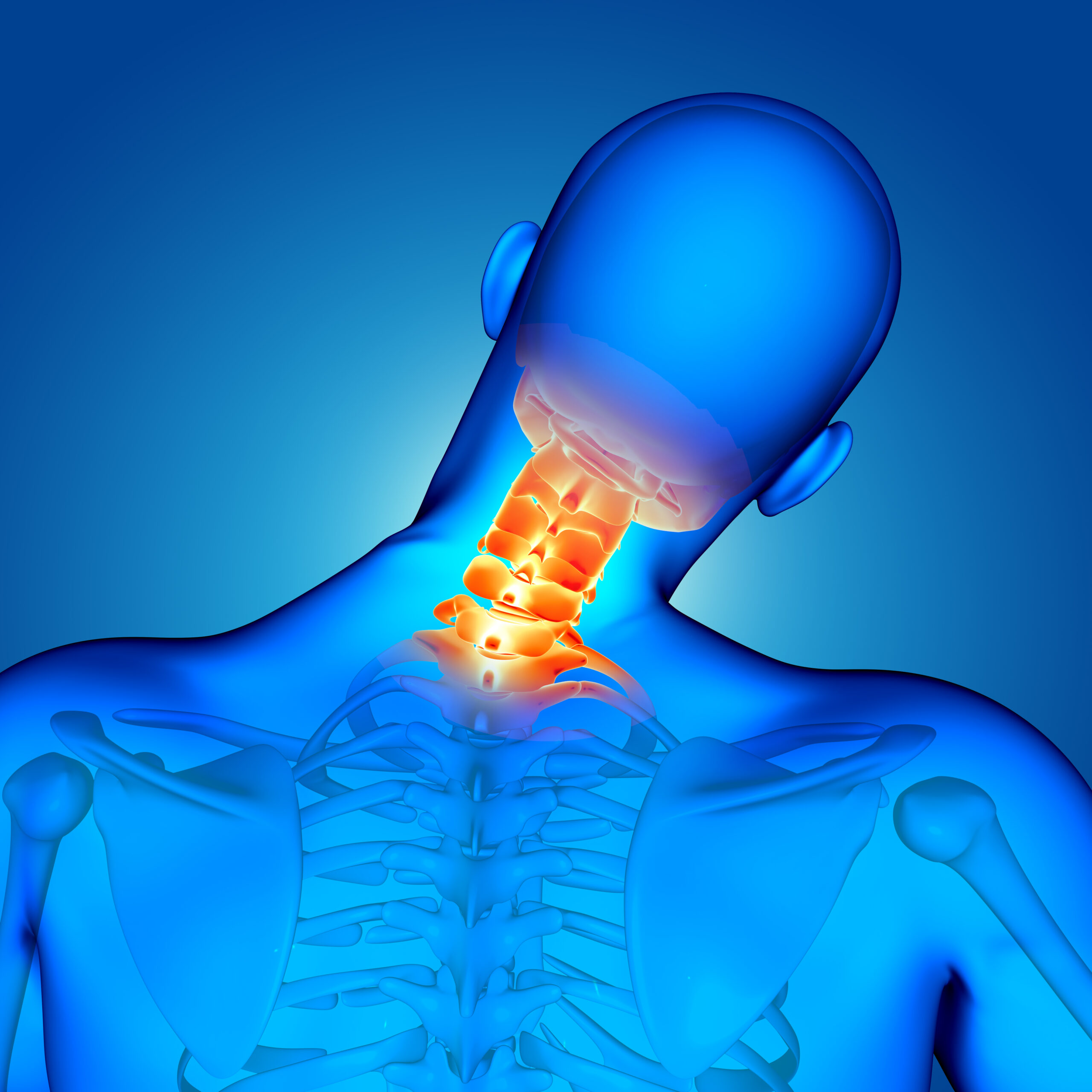3D medical illustration of neck bones and cervical spine - Noida Pain Management Clinic