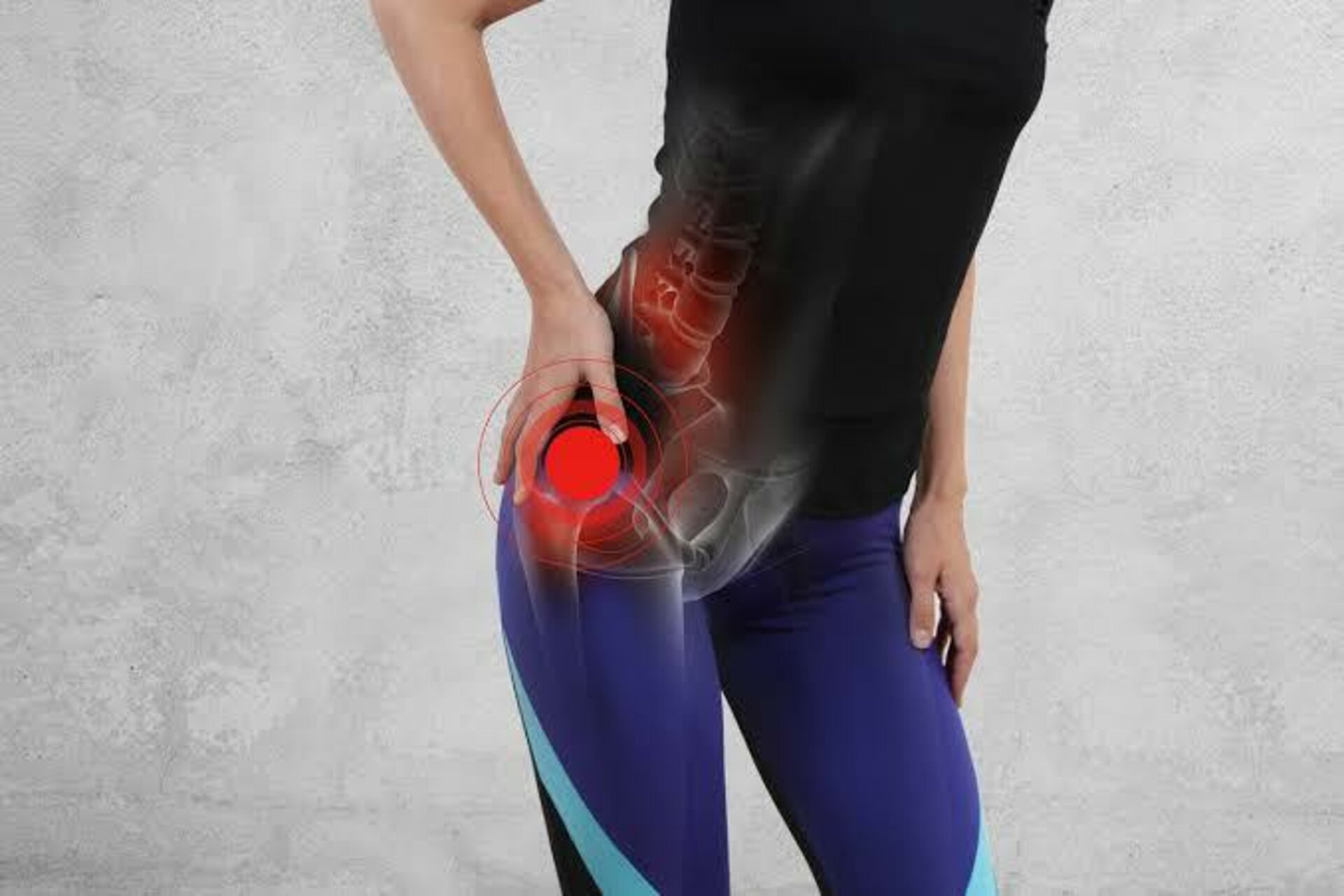 Hip pain anatomy illustration - Noida Pain Management Clinic